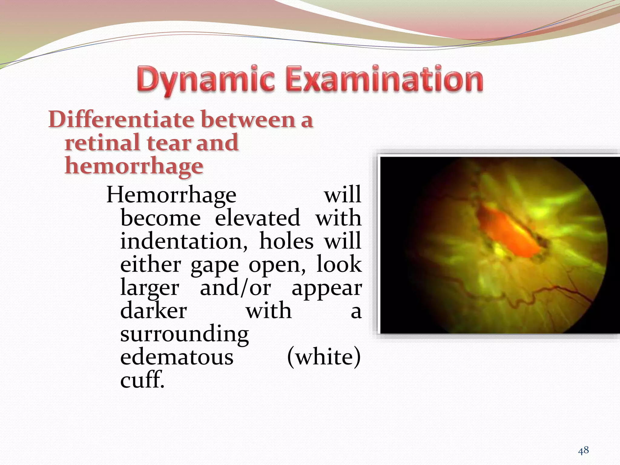 Binocular Indirect OPHTHALMOSCOPY