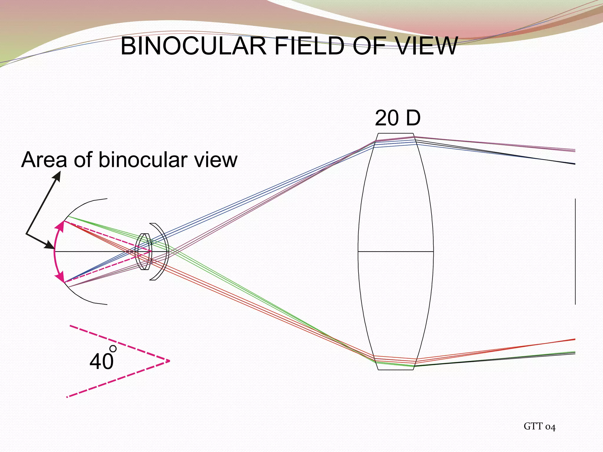 Binocular Indirect OPHTHALMOSCOPY