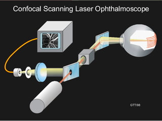 GTT/98
Confocal Scanning Laser Ophthalmoscope
 