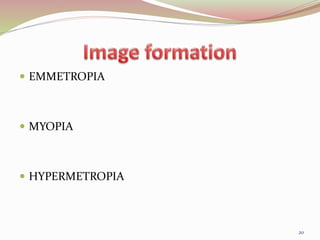  EMMETROPIA
 MYOPIA
 HYPERMETROPIA
20
 