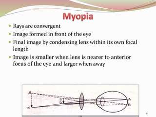  Rays are convergent
 Image formed in front of the eye
 Final image by condensing lens within its own focal
length
 Image is smaller when lens is nearer to anterior
focus of the eye and larger when away
22
 