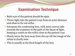  Both eyes of the patient should be open
 Throw light into the patient’s eye from an arm’s distance
and observe for red reflex
 Interpose the condensing lens, with more convex side
towards the examiner in the path of the beam of light,
keeping a watch on the reflex close to the patient’s eye
 Slowly move the lens away from the eye till the image of the
retina is clearly seen
 This is usually at the focal length of the lens
34
 