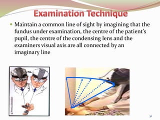 Maintain a common line of sight by imagining that the
fundus under examination, the centre of the patient’s
pupil, the centre of the condensing lens and the
examiners visual axis are all connected by an
imaginary line.
36
 