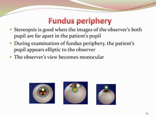  Stereopsis is good when the images of the observer’s both
pupil are far apart in the patient’s pupil
 During examination of fundus periphery, the patient’s
pupil appears elliptic to the observer
 The observer’s view becomes monocular
39
 