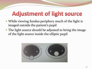  While viewing fundus periphery much of the light is
imaged outside the patient’s pupil
 The light source should be adjusted to bring the image
of the light source inside the elliptic pupil
40
 