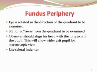  Eye is rotated in the direction of the quadrant to be
examined
 Stand 180° away from the quadrant to be examined
 Observer should align his head with the long axis of
the pupil. This will allow wider exit pupil for
stereoscopic view
 Use scleral indenter
42
 