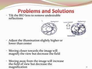 • Tilt the BIO lens to remove undesirable
reflections
• Adjust the illumination slightly higher or
lower than center
• Moving closer towards the image will
magnify the view but decrease the field
• Moving away from the image will increase
the field of view but decrease the
magnification 45
 