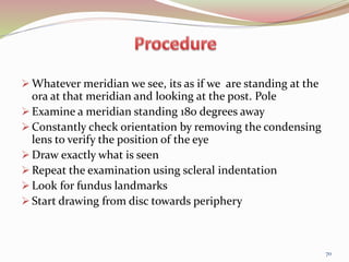  Whatever meridian we see, its as if we are standing at the
ora at that meridian and looking at the post. Pole
 Examine a meridian standing 180 degrees away
 Constantly check orientation by removing the condensing
lens to verify the position of the eye
 Draw exactly what is seen
 Repeat the examination using scleral indentation
 Look for fundus landmarks
 Start drawing from disc towards periphery
70
 