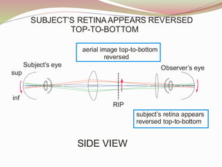 Subject’s eye
SIDE VIEW
sup
inf
RIP
Observer’s eye
aerial image top-to-bottom
reversed
subject’s retina appears
reversed top-to-bottom
SUBJECT’S RETINA APPEARS REVERSED
TOP-TO-BOTTOM
 