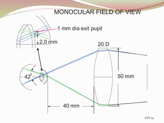 42
40 mm
50 mm
20 D
1 mm dia exit pupil
2.0 mm
MONOCULAR FIELD OF VIEW
GTT 04
 