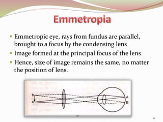  Emmetropic eye, rays from fundus are parallel,
brought to a focus by the condensing lens
 Image formed at the principal focus of the lens
 Hence, size of image remains the same, no matter
the position of lens.
21
 