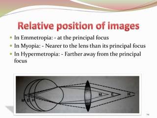  In Emmetropia: - at the principal focus
 In Myopia: - Nearer to the lens than its principal focus
 In Hypermetropia: - Farther away from the principal
focus
24
 