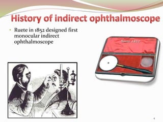 • Ruete in 1852 designed first
monocular indirect
ophthalmoscope
4
 