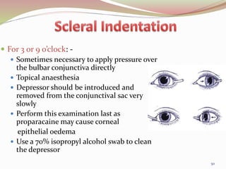  For 3 or 9 o’clock: -
 Sometimes necessary to apply pressure over
the bulbar conjunctiva directly
 Topical anaesthesia
 Depressor should be introduced and
removed from the conjunctival sac very
slowly
 Perform this examination last as
proparacaine may cause corneal
epithelial oedema
 Use a 70% isopropyl alcohol swab to clean
the depressor
50
 
