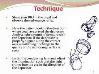  Shine your BIO in the pupil and
observe the red-orange reflex
 Have the patient look in the direction
where you have placed the depressor.
Apply a light amount of pressure with
the depressor. If the depressor is
properly aligned along the correct
axis, a darkening or change in the
quality of the red- orange reflex is
seen
 Insert the condensing lens and adjust
the illumination such that the light
shines into the eye in the direction of
the depressor
53
 