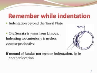  Indentation beyond the Tarsal Plate
 Ora Serrata is 7mm from Limbus.
Indenting too anteriorly is useless
counter productive
If mound of fundus not seen on indentation, its in
another location
55
 