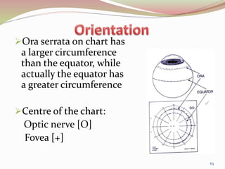 Ora serrata on chart has
a larger circumference
than the equator, while
actually the equator has
a greater circumference
Centre of the chart:
Optic nerve [O]
Fovea [+]
63
 
