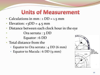 • Calculations in mm : 1 DD = 1.5 mm
• Elevation: +3DD = 4.5 mm
• Distance between each clock hour in the eye
• Ora serrata : 3 DD
• Equator : 6 DD
• Total distance from the
• Equator to Ora serrata : 4 DD (6 mm)
• Equator to Macula : 6 DD (9 mm)
68
 