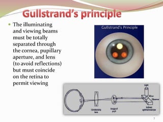  The illuminating
and viewing beams
must be totally
separated through
the cornea, pupillary
aperture, and lens
(to avoid reflections)
but must coincide
on the retina to
permit viewing
7
 