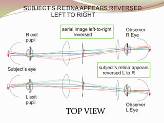 Subject’s eye
Observer
R Eye
L exit
pupil
R exit
pupil
Observer
L Eye
aerial image left-to-right
reversed
subject’s retina appears
reversed L to R
SUBJECT’S RETINAAPPEARS REVERSED
LEFT TO RIGHT
TOP VIEW
 