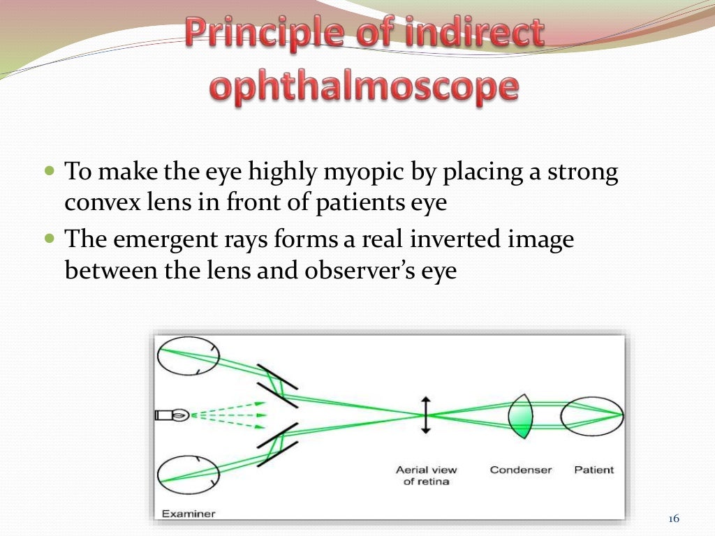 Binocular Indirect Ophthalmoscopy