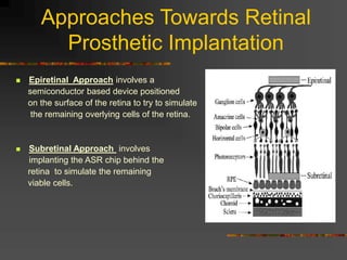 Approaches Towards Retinal
Prosthetic Implantation
 Epiretinal Approach involves a
semiconductor based device positioned
on the surface of the retina to try to simulate
the remaining overlying cells of the retina.
 Subretinal Approach involves
implanting the ASR chip behind the
retina to simulate the remaining
viable cells.
 
