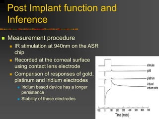 Post Implant function and
Inference
 Measurement procedure
 IR stimulation at 940nm on the ASR
chip
 Recorded at the corneal surface
using contact lens electrode
 Comparison of responses of gold,
platinum and iridium electrodes
 Iridium based device has a longer
persistence
 Stability of these electrodes
 