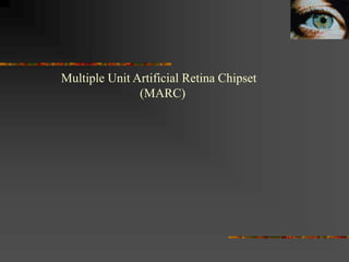 Multiple Unit Artificial Retina Chipset
(MARC)
 