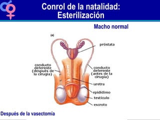 Conrol de la natalidad: Esterilización Después de la vasectomía Macho normal 
