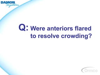 Q: Were anteriors flared
   to resolve crowding?
 