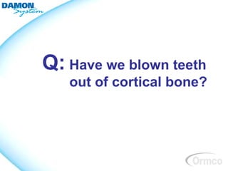 Q: Have we blown teeth
   out of cortical bone?
 