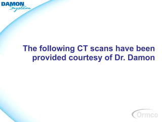 The following CT scans have been
  provided courtesy of Dr. Damon
 