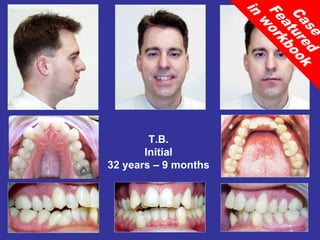 T.B.
       Initial
32 years – 9 months
 