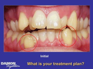 Initial

What is your treatment plan?
 