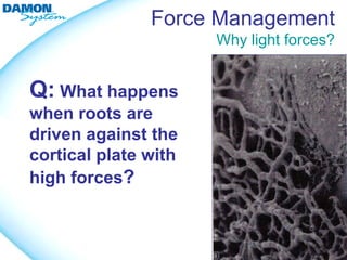 Force Management
                      Why light forces?


Q: What happens
when roots are
driven against the
cortical plate with
high forces?
 