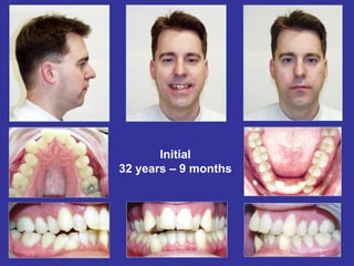 Initial
32 years – 9 months
 