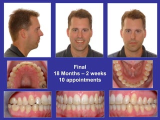 Final
18 Months – 2 weeks
  10 appointments
 