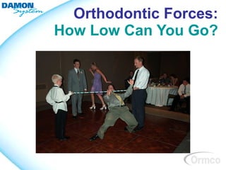 Orthodontic Forces:
How Low Can You Go?
 