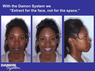 With the Damon System we
    “Extract for the face, not for the space.”
 