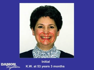 Initial
K.W. at 53 years 3 months
 