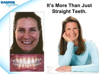 It’s More Than Just
   Straight Teeth.
 