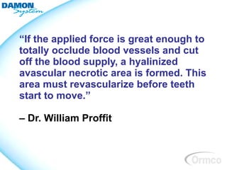 “If the applied force is great enough to
totally occlude blood vessels and cut
off the blood supply, a hyalinized
avascular necrotic area is formed. This
area must revascularize before teeth
start to move.”

– Dr. William Proffit
 