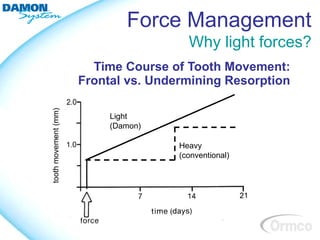 Force Management
                  Why light forces?
  Time Course of Tooth Movement:
Frontal vs. Undermining Resorption

     Light
     (Damon)

                Heavy
                (conventional)
 