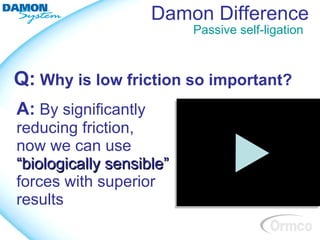 Damon Difference
                          Passive self-ligation



Q: Why is low friction so important?
A: By significantly
reducing friction,
now we can use
“biologically sensible”
forces with superior
results
 
