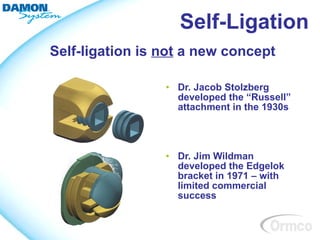 Self-Ligation
Self-ligation is not a new concept

                 • Dr. Jacob Stolzberg
                   developed the “Russell”
                   attachment in the 1930s




                 • Dr. Jim Wildman
                   developed the Edgelok
                   bracket in 1971 – with
                   limited commercial
                   success
 