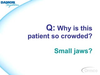 Q: Why is this
patient so crowded?

       Small jaws?
 