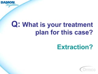 Q: What is your treatment
       plan for this case?

              Extraction?
 