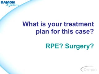 What is your treatment
   plan for this case?

       RPE? Surgery?
 