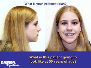What is your treatment plan?




   What is this patient going to
   look like at 50 years of age?
 