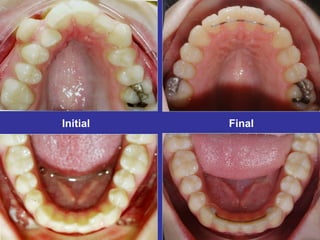 Initial           Final


            Final
22 months
         3 weeks
 